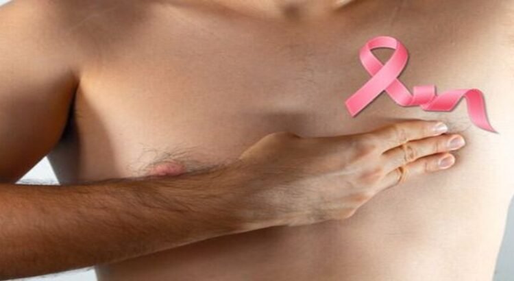 Detectan 2 casos de cáncer de mama en hombres en Michoacán en último año